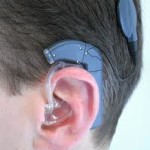 reabilitação auditiva com o implante coclear
