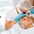 Sinais na pele de uma mulher indicaram quando ir ao dermatologista