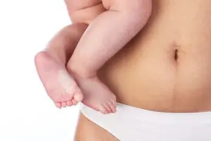 Uma mulher com diástase abdominal segurando um bebê nos braços